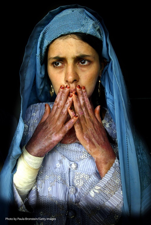 절박함으로 분신자살을 시도한 헤라트 여성 2004.10.22 ⓒPhoto by Paula Bronstein/Getty Images