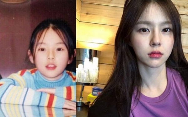 조수애 임신/사진=온라인 커뮤니티