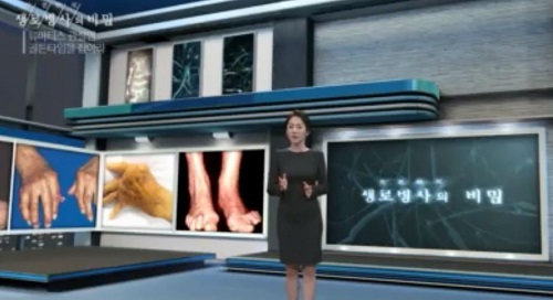 생로병사의 비밀/사진=KBS