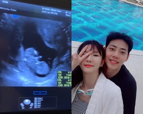 사진=정아 SNS