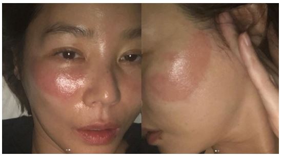 김성령 부작용/사진=김성령 SNS